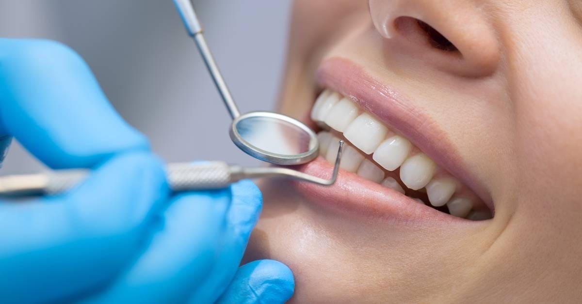 Tips for Saving Money While Taking Care of Your Teeth
