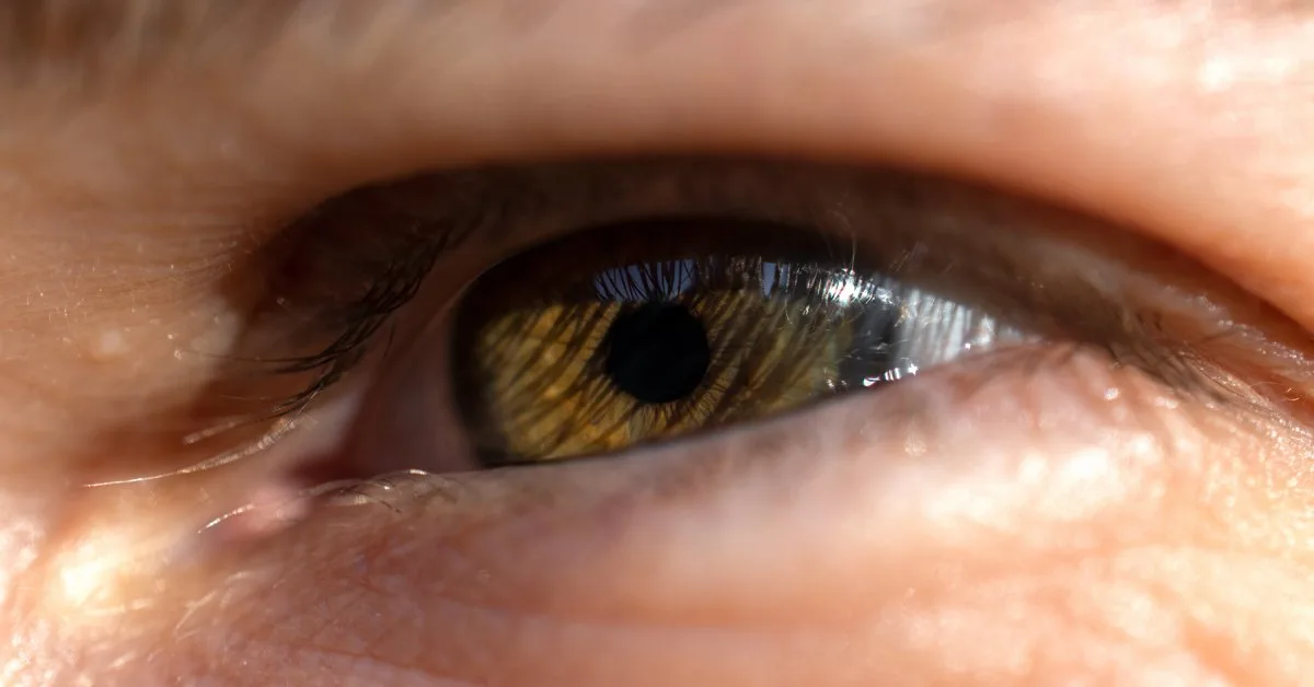 What Are Hooded Eyes and How Can You Treat Them?